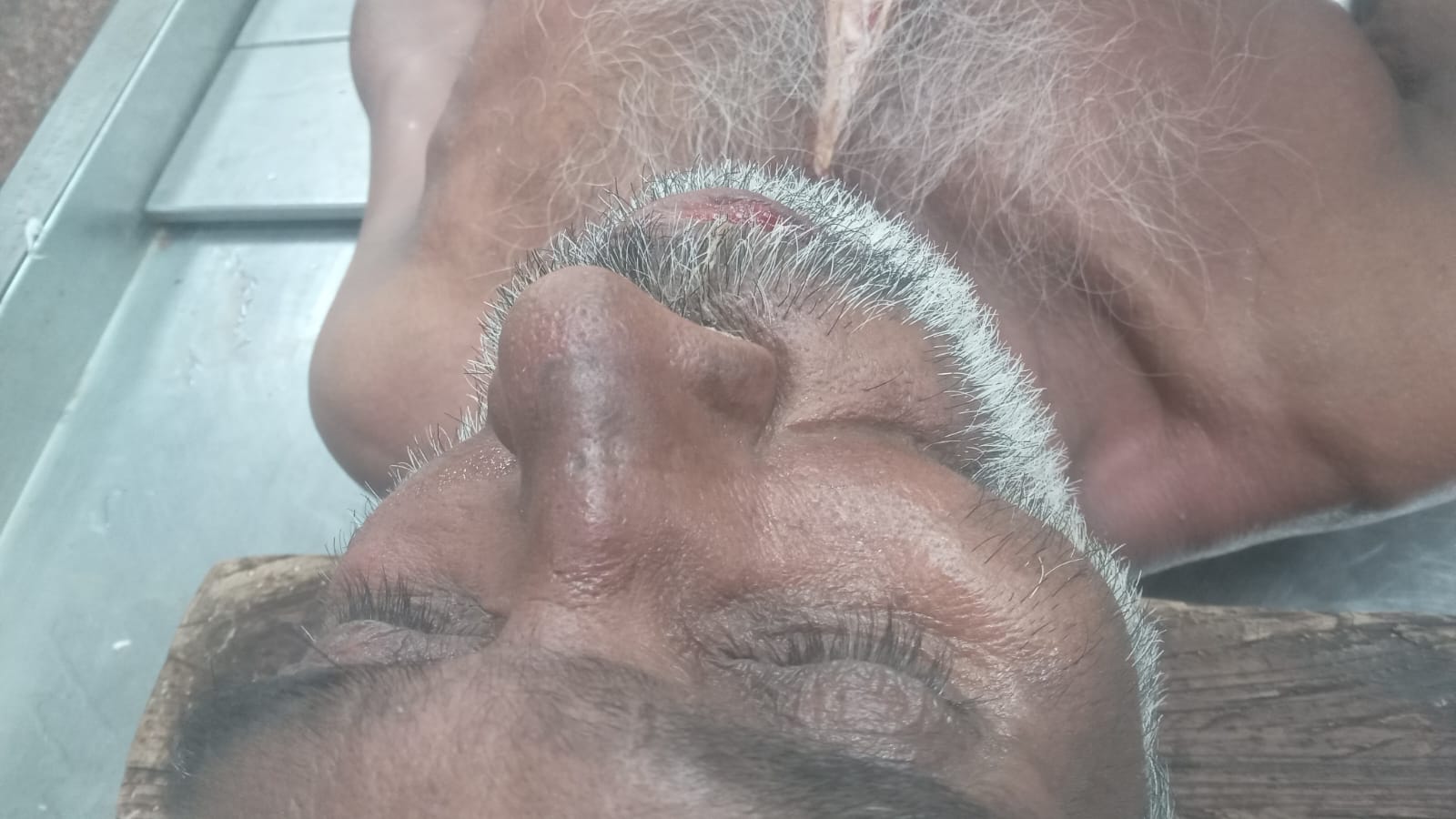 Scar Image